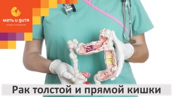 Рак толстой и прямой кишки